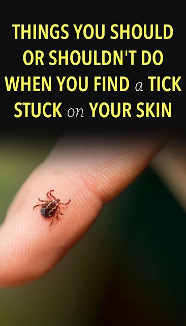 Things You Should or Shouldn’t Do When You Find a Tick Stuck on Your Skin