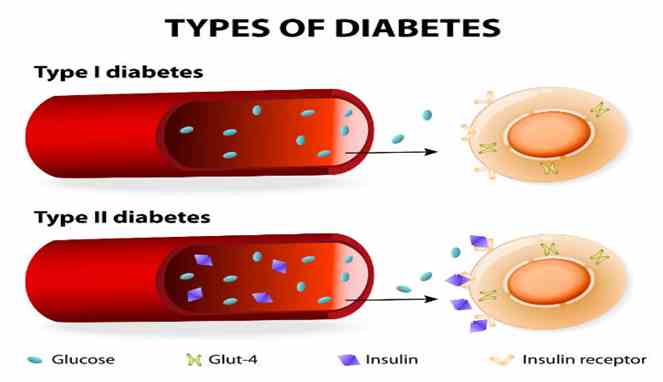 Enam Fakta Diabetes Tipe 2 yang Belum Banyak Orang Ketahui