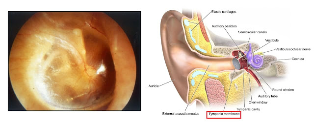 Tympanic membrane