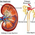 Is it true that you are suffering "Kidney Failure"?