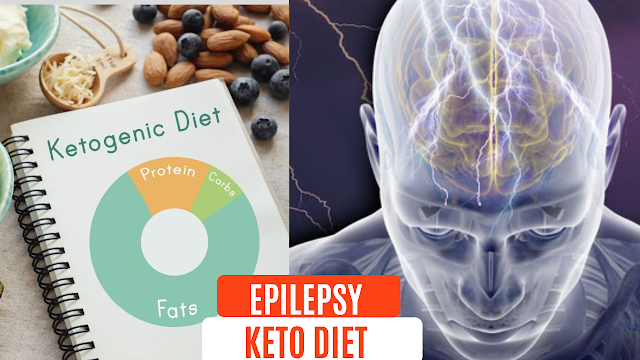 keto-diet-for-epilepsy-in-adults