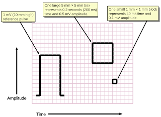 Hasil gambar untuk kertas EKG