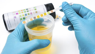  cara sederhana mendiagnosa kondisi kesehatan dengan melihat sembilan warna urine