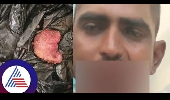 A young man from Bellary cut off his tongue because God told him in a dream!
