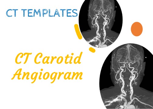 CT Carotid Angiogram
