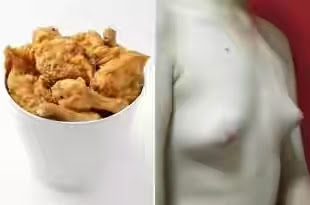 Omg! Man Develops Breast After Eating Fried Chicken