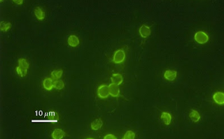 Cryptosporidium