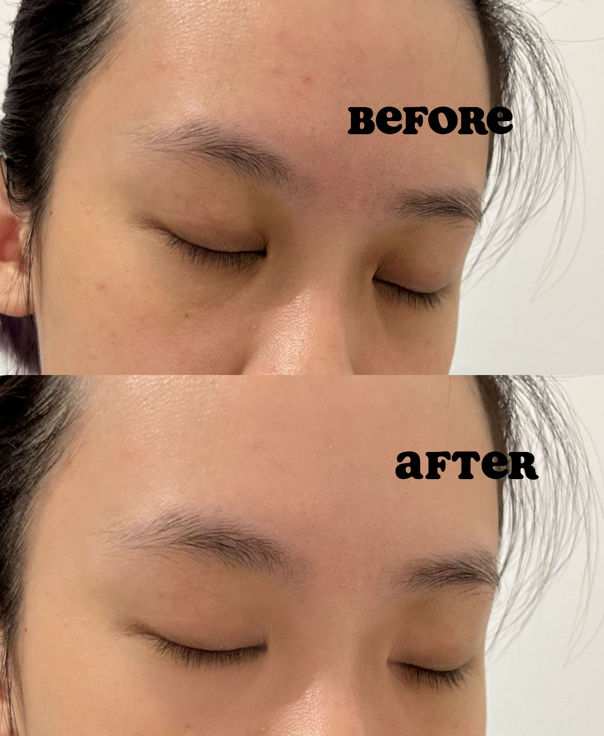 glad2glow review before after