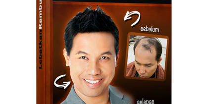 Rahsia Tips Melebatkan Rambut Gugur Dalam 30 HARI Secara 