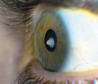 Unique Facts About Human Eyes