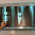 Médicos chinos logran implantar huesos fabricados con impresora 3D