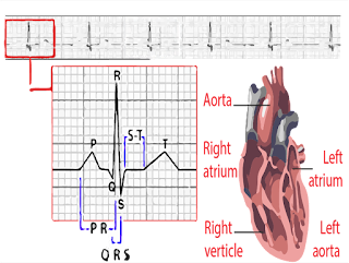 ECG