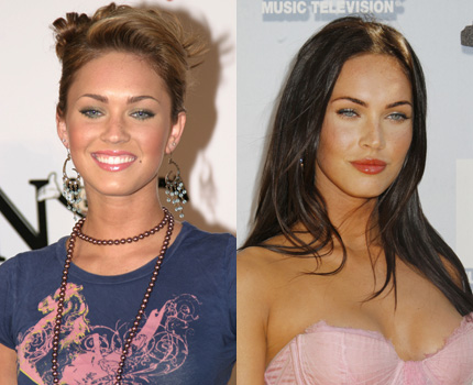 megan fox before and after plastic surgery