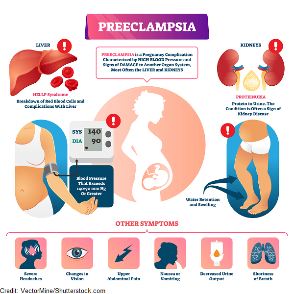 Preventing and Managing Preeclampsia in Pregnancy: Early Detection, Diet Manipulation and Treatment