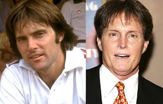 Bruce Jenner plastic surgery before and after | Bruce Jenner plastic surgery photos