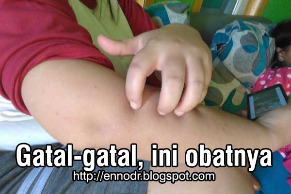 Menyembuhkan gatal-gatal diseluruh tubuh