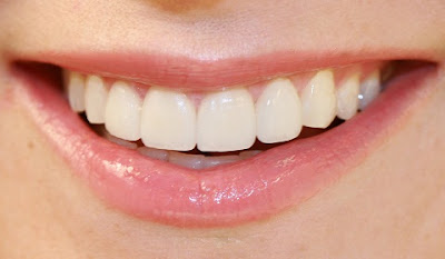 White Clean Teeth