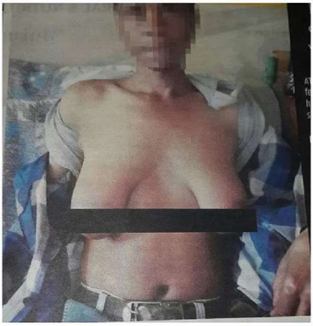 Man Allegedly Grows Breasts After Sleeping With Neighbour’s Wife