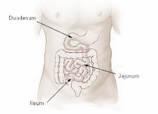 intestin grêle jejunum duodenum ileum infirmier