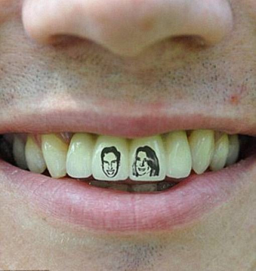 TheFacemash Post - Seorang Tukang Ledeng Mentato Gigi depannya Dengan Tato Gambar Pangeran William dan Kate Middleton