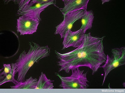 Bone cells imaged using confocal microscopy