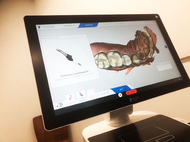 PrimeScan dental technology for 3D imaging of teeth (Source: Palmia Observatory)