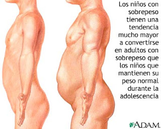 Prevenir la obesidad desde la infancia