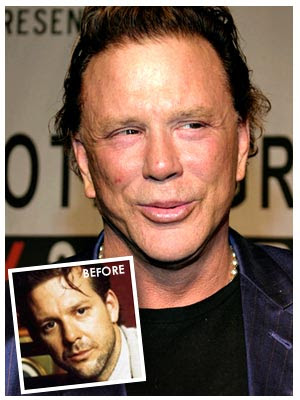 Mickey Rourke Bad Nose Jobs