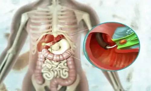 DRINK 1 CUP PER DAY to Remove Fat from Your Liver