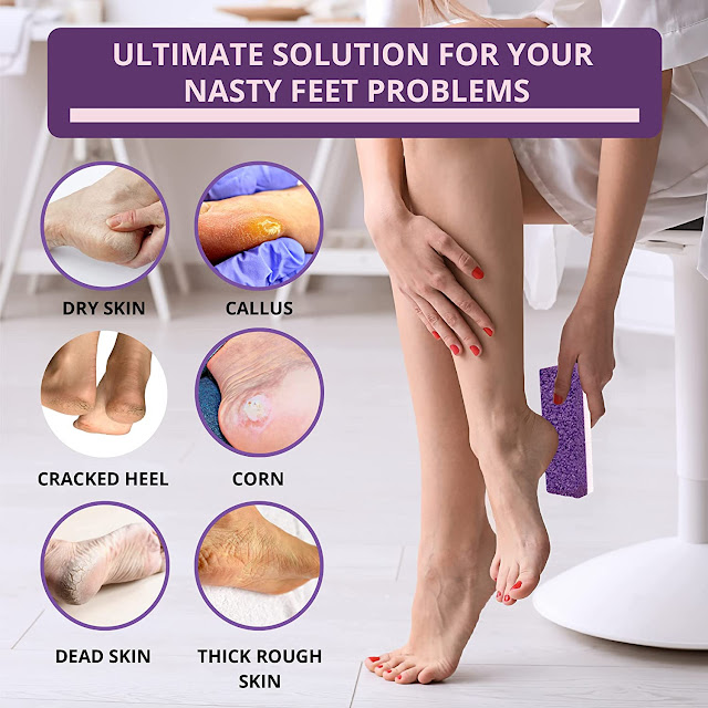 pumice stone for exfoliating cracked heels, Best Foot Exfoliator Tool