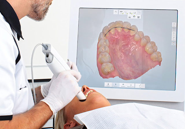 Intra oral dental scanner at jamnagar dental clinic