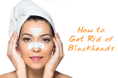 How to Remove Blackheads