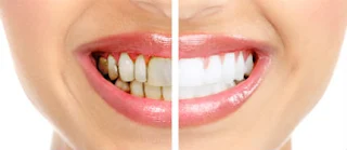 regenerate dental enamel