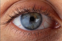 Resultado de imagen para esclerótica del ojo blanca
