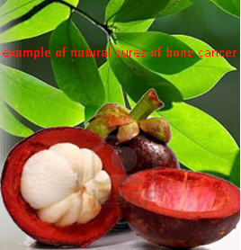 Bone Cancer Natural Cures and treatments