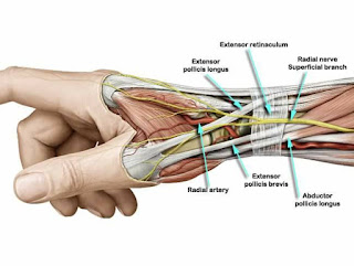 saraf radialis tertekan oleh wartenbers syndrome