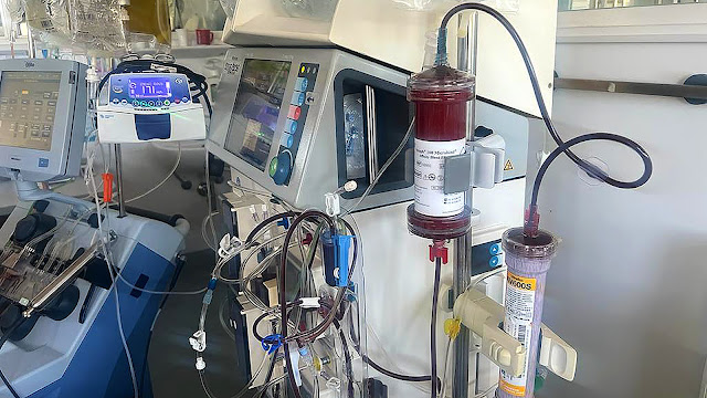 “So while we wait to get things like vaccines or paxlovid, remdesivir or other medications, [the filter can] buy us time for the most critically ill patients. That's the overarching concept,” says Stewart. (Photo courtesy of  ExThera Medical).