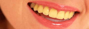 10 Causes of Yellow Teeth