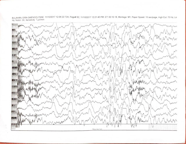 EEG test result