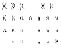 Fhoto NHGRI_human_male_karyotype