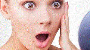 acne-vulgaris