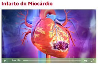  Enfarte do miocárdio - Blausen