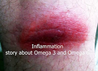 Inflammation – story about Omega 3 and Omega 6