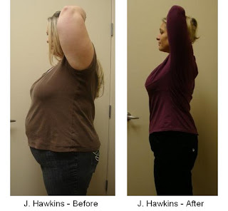 J. Hawkins weight loss Before and after