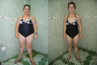 suziane burguez proença cirurgia bariatrica gastroplastia antes e depois