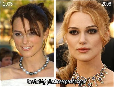 megan fox before and after nose job. Megan Fox. Keira Knightley