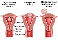 планирование беременности