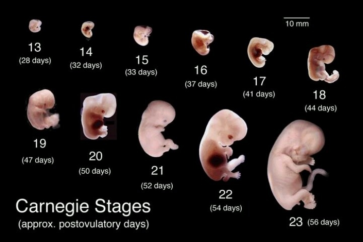 The Blog Fodder: Human Fetal Development  Part 2