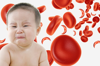 Trẻ sơ sinh thiếu máu và những nguy cơ khôn lường