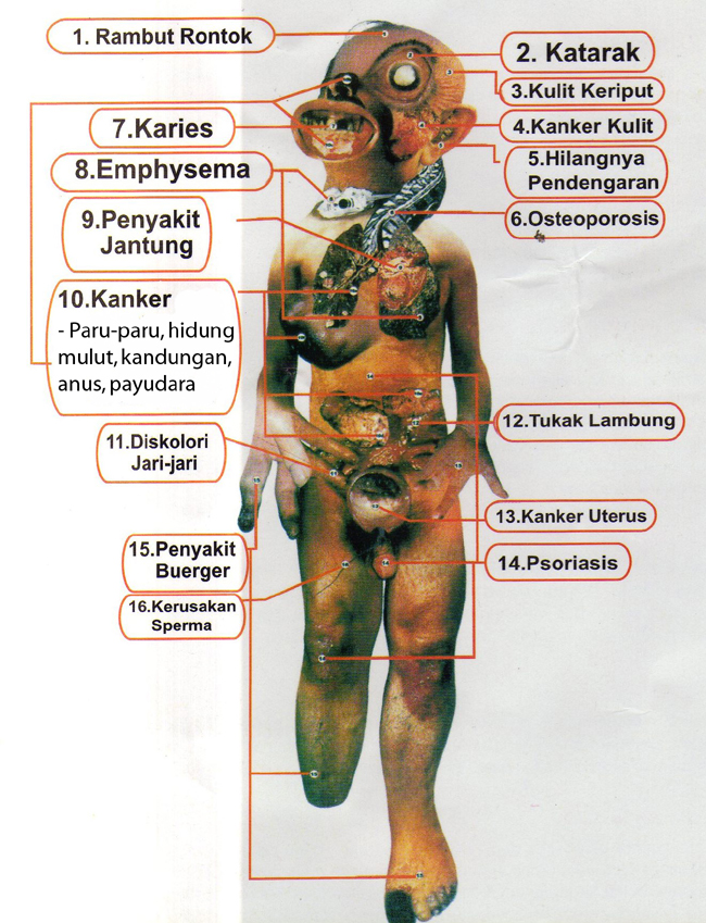 1001 Dampak : Dampak dan efek dari Merokok